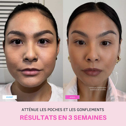 Appareil anti-ride + 2 Sérums OFFERTS