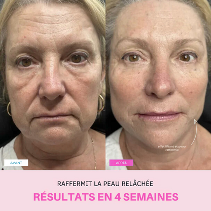 Appareil anti-ride + 2 Sérums OFFERTS