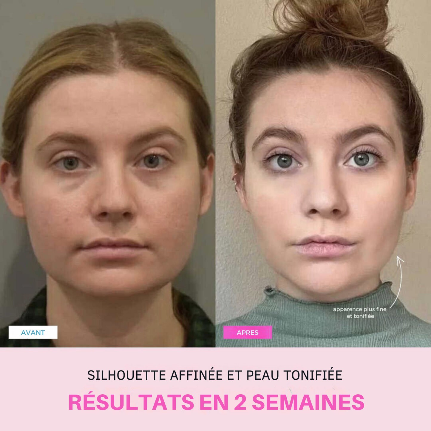 Appareil anti-ride + 2 Sérums OFFERTS
