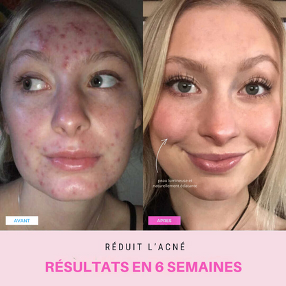 Appareil anti-ride + 2 Sérums OFFERTS
