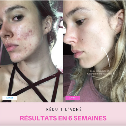 Appareil anti-ride + 2 Sérums OFFERTS